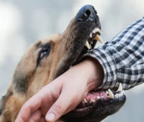 Dog Bites Cases